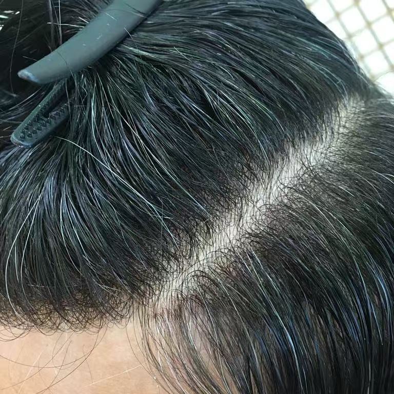 Worn top view showing natural scalp illusion at center part on real head